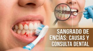Sangrado de encias y consulta dental