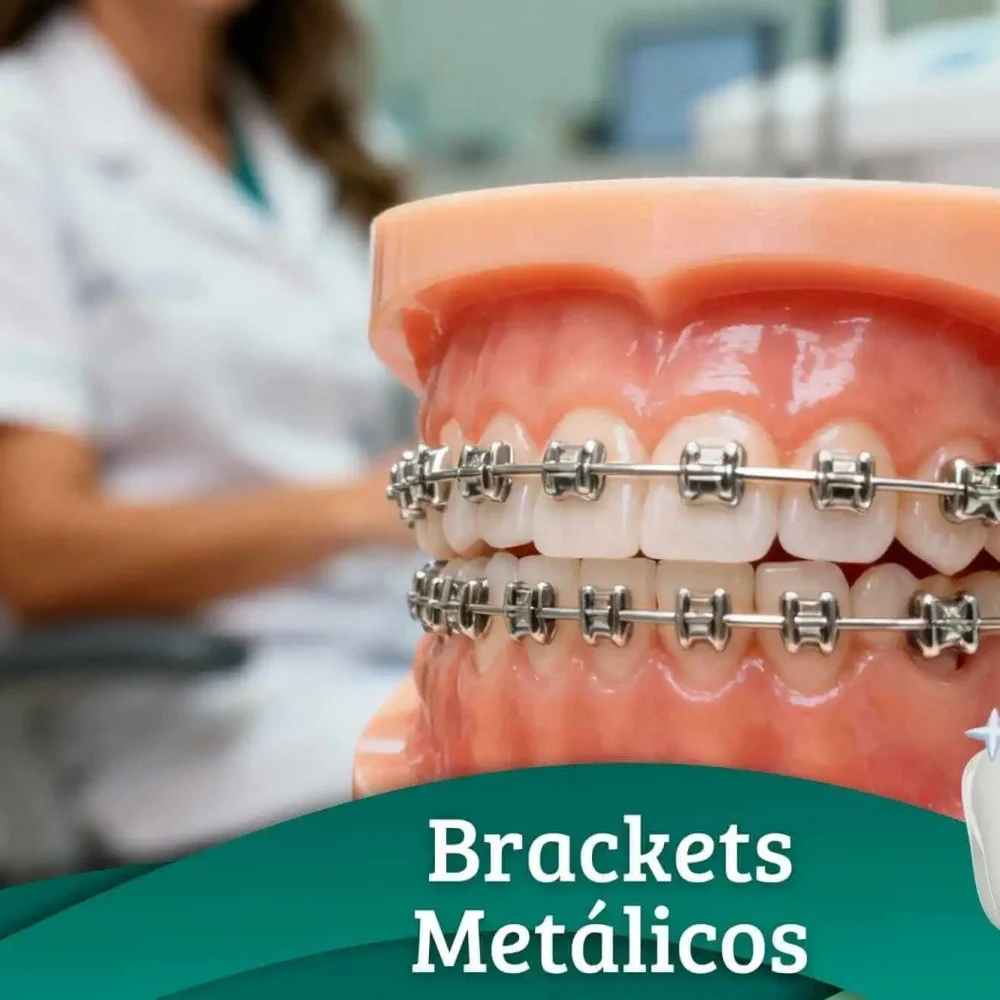 bracket-metálicos