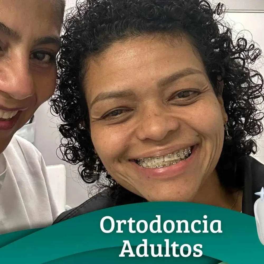 ortodoncia-para-adultos